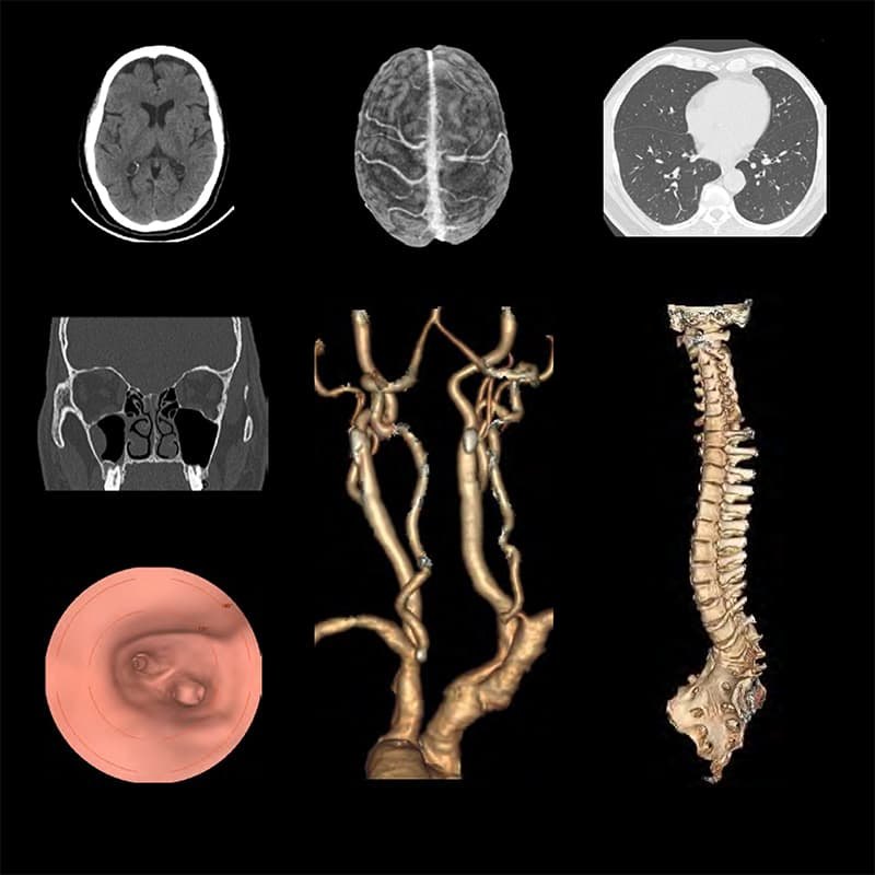 Компьютерный томограф Revolution ACT